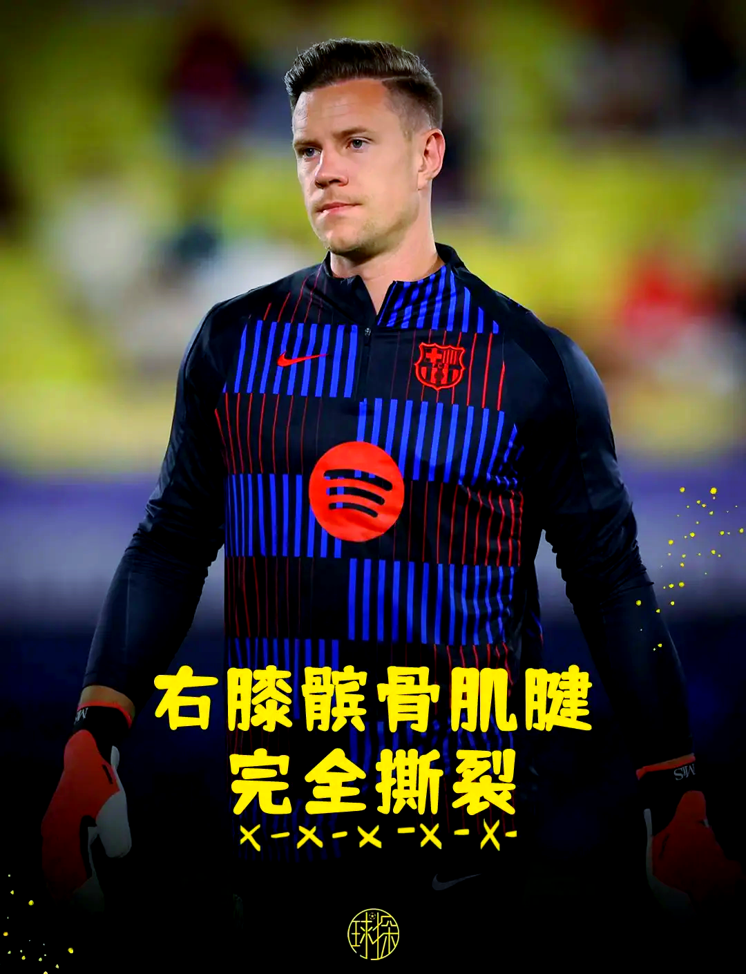 AYX-包含巴塞罗那冲刺阶段伤情更新，志在意大利杯名次提升，震撼外界，训练强度显著提升的词条